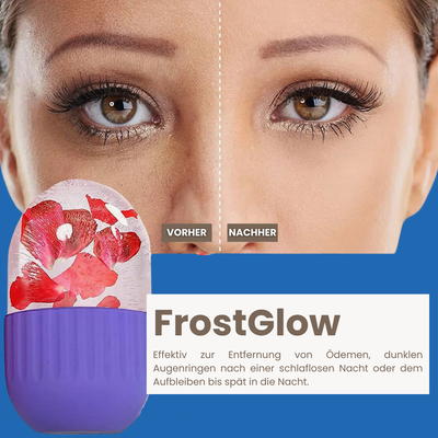 FrostGlow - Ice Roller